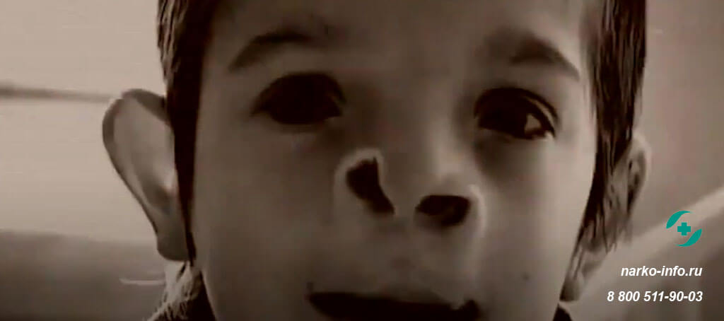 Лицо ребенка алкоголиков