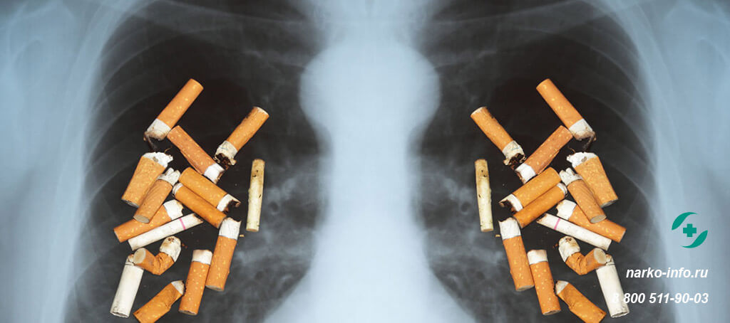 Болит сердце после курения: что делать с проблемой после бросания привычки