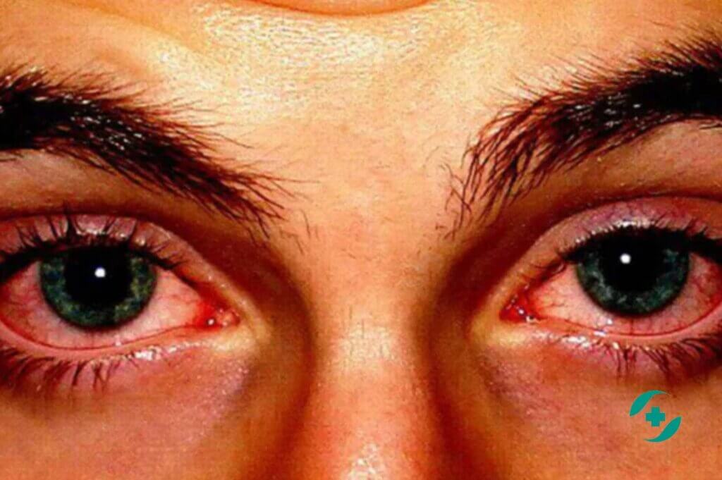 OMG! One Of The Best Koka Hash Mefedron Ever!